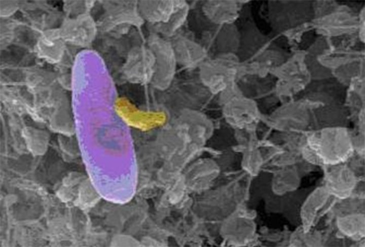 A bactéria Micavibrio aeruginosavorus recebe a alcunha de menor vampiro do mundo, mas é um título positivo. Isso porque ela se alimenta de outras bactérias. 