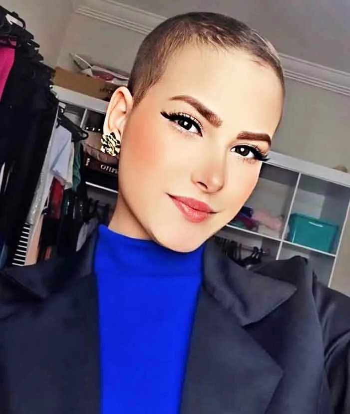 Camila Trevisol foi vítima de um sarcoma de Ewing, um tipo raro e agressivo de câncer ósseo. Ela recebeu esse diagnóstico em 2023, após já ter enfrentado um primeiro tumor no fêmur entre 2016 e 2017. 
