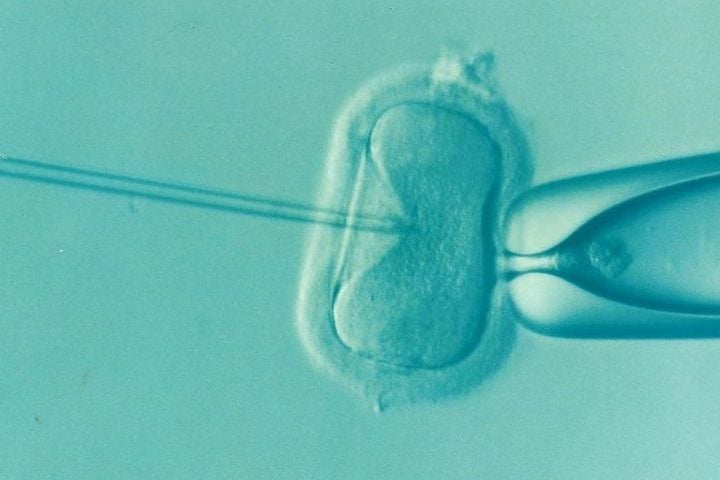 A fertilização in vitro (FIV) é uma técnica de reprodução assistida que consiste em fecundar o óvulo com o espermatozoide fora do corpo da mulher, em laboratório. 