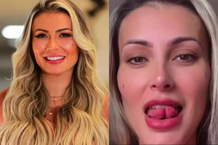 Em 2024, implantou um mega hair avaliado em R$ 100 mil, utilizando fios de ouro 24k. No mesmo ano, ela dividiu a língua ao meio como uma forma de “romper com o passado religioso”.