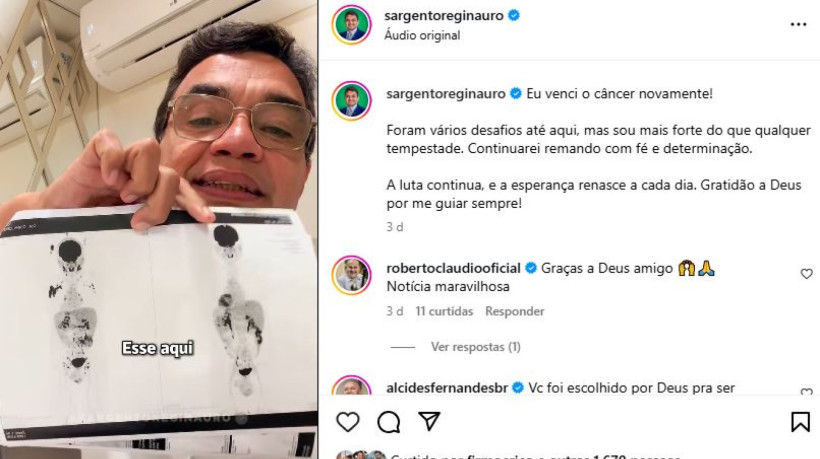 Nas redes sociais, Reginauro publicou sobre cura, recebendo mensagens de apoio de colegas da política e eleitores