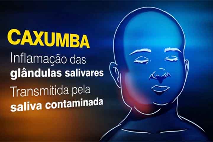No caso de Rodrigo Faro, o chamado “bumbum de gaveta” - termo que ele usou para descrever a aparência menos arredondada dos glúteos - está relacionado a uma complicação rara da caxumba. Embora o vírus costume afetar as glândulas salivares, ele também pode provocar inflamações em outros tecidos, inclusive musculares. 
