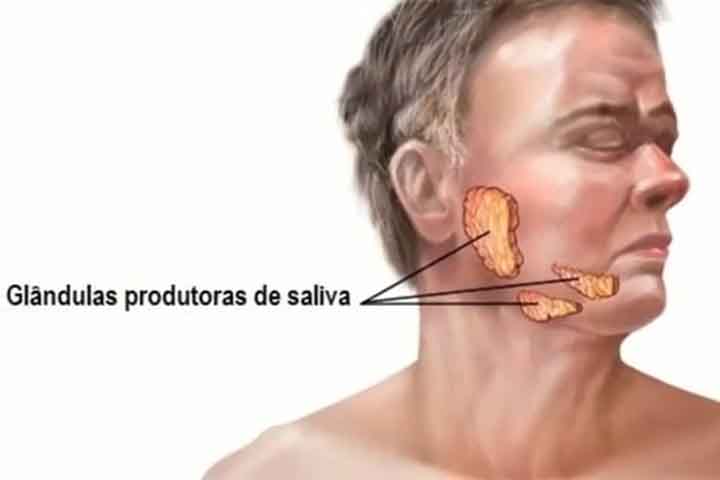 No caso do inchaço nas glândulas, é recomendável fazer compressas mornas na região para aliviar o desconforto. 
