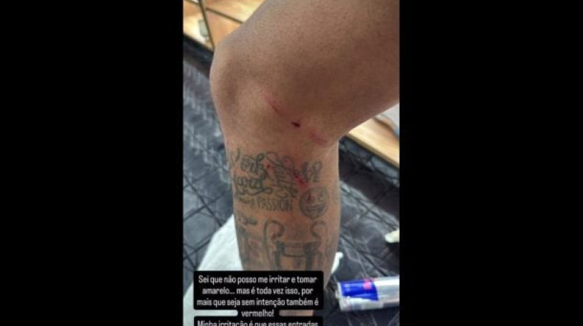 Craque do Peixe questionou os critérios da arbitragem após contatos que deixaram ferimentos durante o embate contra os cariocas