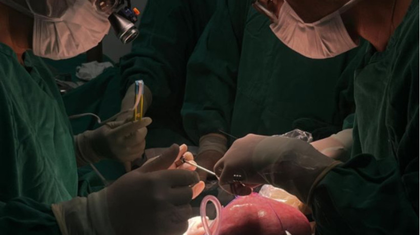 A primeira cirurgia com útero exposto foi realizada em 2019 no Ceará