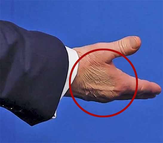 Em julho de 2025, o governante surgiu com a mão direita aparentemente coberta por maquiagem - o que alguns especularam ter o objetivo de disfarçar alterações na pele. 
