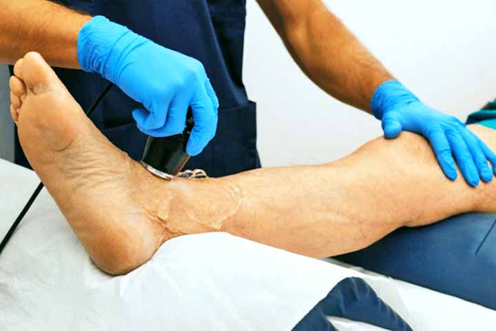 Sean P. Barbabella, médico de Donald Trump, informou que essa condição é comum em adultos com mais de 70 anos, afetando entre 10% e 35% das pessoas nessa faixa etária.