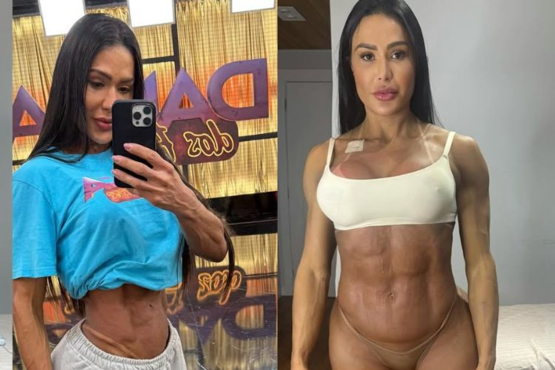 Gracyanne Barbosa mostra antes e depois do corpo após lesão no ‘Dança dos Famosos’