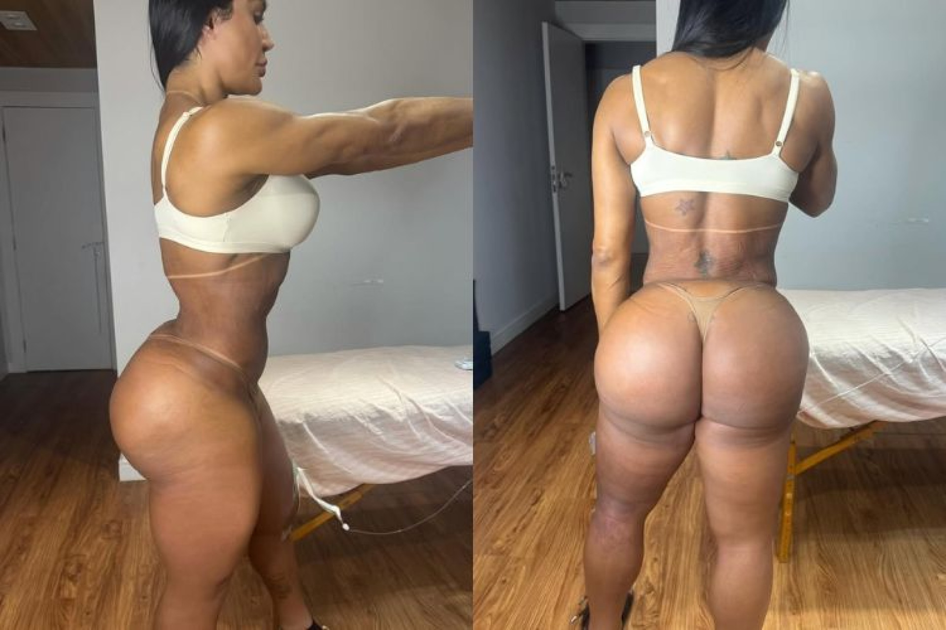 Gracyanne Barbosa mostra antes e depois do corpo ap&oacute;s les&atilde;o no &lsquo;Dan&ccedil;a dos Famosos&rsquo;
