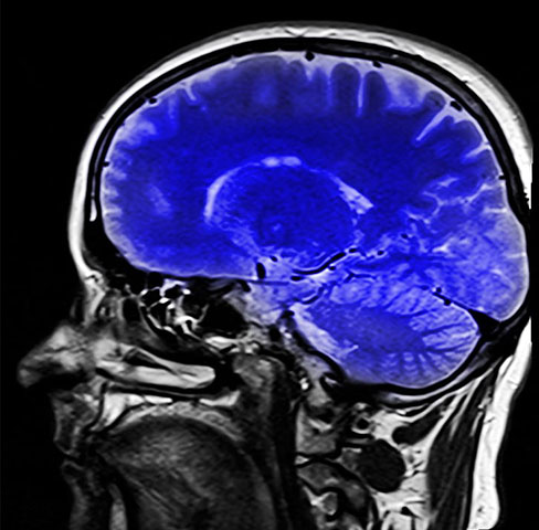 O crochê e outras artes manuais têm se mostrado ferramentas valiosas no enfrentamento do Alzheimer. Ao estimular o cérebro, melhorar a saúde mental e promover a socialização e oferecem benefícios significativos para a prevenção e o tratamento da doença.
