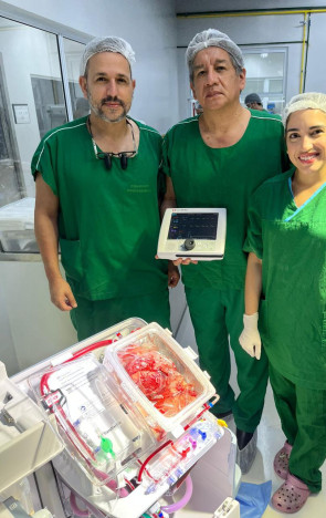 O cirurgião e líder do Programa de Transplantes de Coração no Hospital de Messejana, Juan Mejia, e equipe 