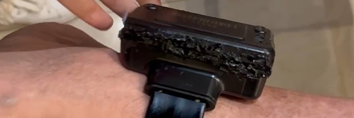 STF revela que Bolsonaro usou ferro de solda em tornozeleira eletrônica