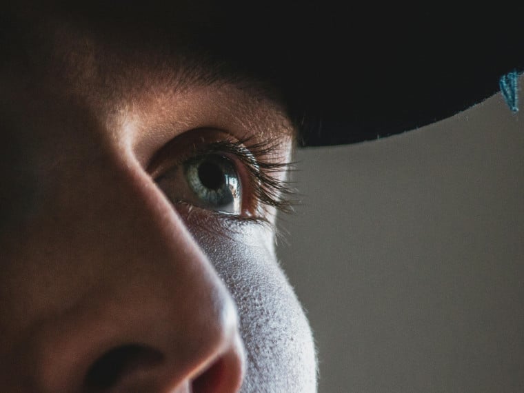 Tendência de raspar os cílios viralizou no TikTok. Raspagem pode trazer diversos riscos, alertam oftalmologistas 