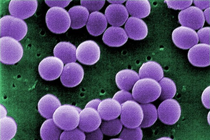 O agente mais comum da osteomielite é a bactéria Staphylococcus aureus.
