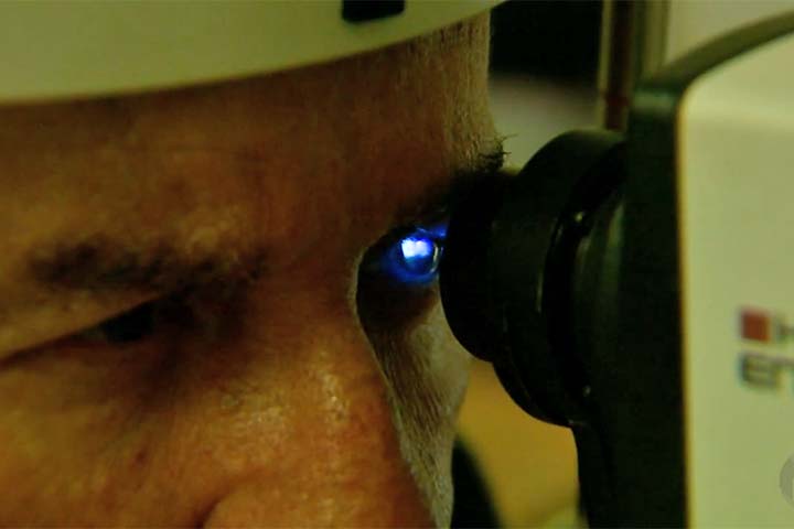 A degeneração macular relacionada à idade (DMRI) é a variação mais conhecida e costuma afetar pessoas acima dos 50 ou 60 anos. 
