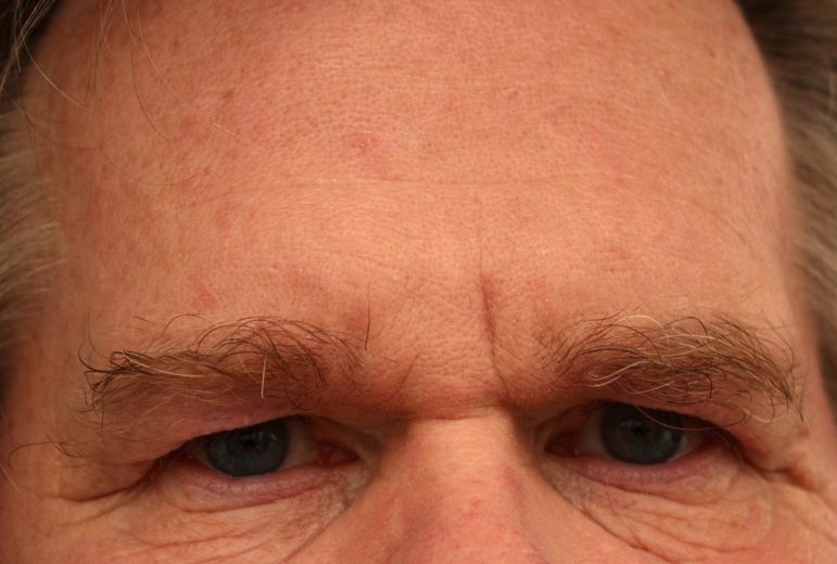 Agora olha essa: em um evento ocorrido em 2005, o cidadão norte-americano Andrew Fischer decidiu leiloar sua própria testa para servir como um outdoor humano de propaganda.