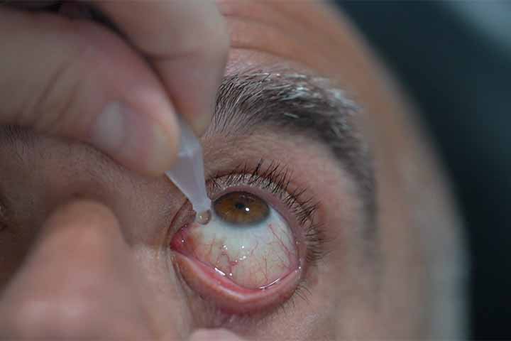 A aceclidina, molécula que serve de base para o produto, é conhecida há décadas no tratamento de glaucoma. 
