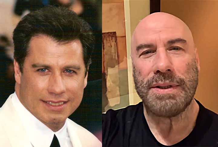 John Travolta – ator americano, nascido em 1954. Assumiu o visual careca de forma definitiva no fim dos anos 2010, após a perda natural de cabelo, decisão que ele próprio passou a exibir publicamente em eventos e entrevistas.