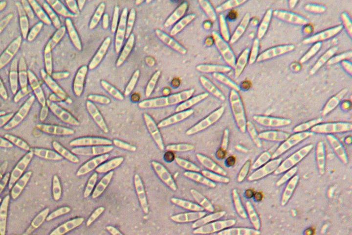 Apesar de seu papel como patógeno, algumas cepas de Fusarium oxysporum são estudadas por seu potencial em biotecnologia e no controle biológico de outras pragas e doenças.
