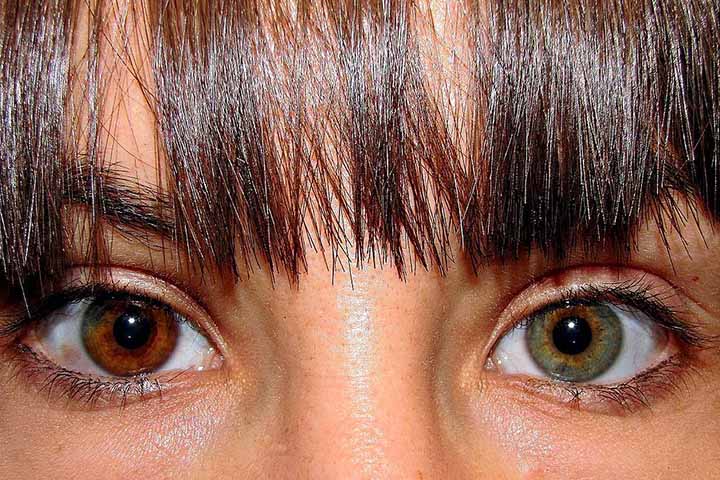 Você já ouviu falar em heterocromia? Trata-se de uma condição em que uma pessoa apresenta diferença de cor nas íris dos olhos. 
