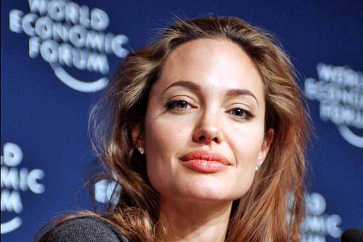 Angelina Jolie - A celebrada atriz de Hollywood apresenta heterocromia setorial em seus olhos â uma discreta variaÃ§Ã£o de cor dentro da mesma Ã­ris, com tons que podem variar entre azul, verde, cinza e castanho dependendo da luz, maquiagem e contexto. 
