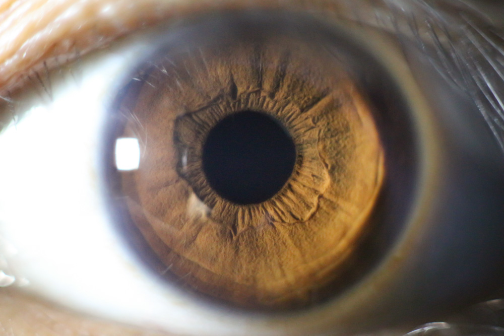 Usar óculos escuros sem essa proteção pode ser mais arriscado do que não usar nada, já que a dilatação da pupila provocada por lentes escuras facilita a entrada de radiação nociva.
