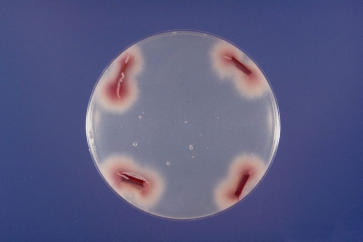 Fusarium oxysporum é um fungo filamentoso amplamente distribuído no solo e conhecido por sua capacidade de causar doenças em uma grande variedade de plantas.