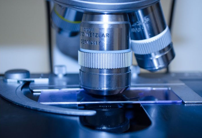 Em geral, os médicos analisam o ABCD da mancha e, caso desconfiem, aspiram um pedaço e enviam para a biópsia. No laboratório, há a confirmação ou não da doença. 