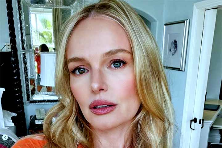 Kate Bosworth - A atriz californiana apresenta heterocromia parcial. O seu olho esquerdo é azul claro, enquanto o direito é composto por uma mescla de azul com tom castanho/avermelhado, formando um contraste marcante. 
