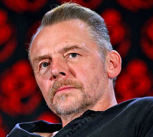 Simon Pegg - O comediante de filmes como Todo Mundo Quase Morto e  Chumbo Grosso possui heterocromia setorial. Ele já descreveu essa condição como “um pouquinho mutante”, explicando em um programa que seus “olhos são azul‑cinza, mas no olho direito eu tenho um flash de marrom.”
