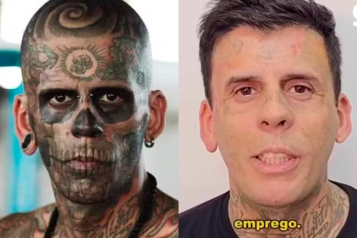 Leandro de Souza, conhecido como o “homem mais tatuado do Brasil”, está removendo as tatuagens do rosto após se converter ao evangelho.