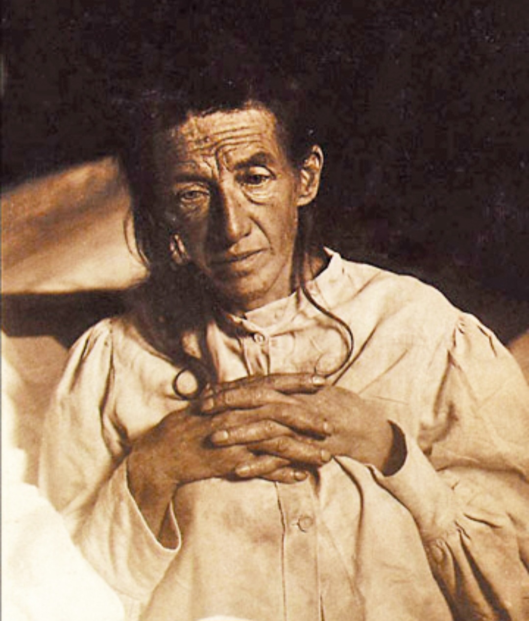 A primeira pessoa diagnosticada com o Mal de Alzheimer foi Auguste Deter, alemã que morreu em 8/4/1906, aos 55 anos. Nascida em Kassel, em 16/5/1850, ela entrou para a história. Adoeceu em 1901, aos 50 anos, e ficou internada o restante da vida. 