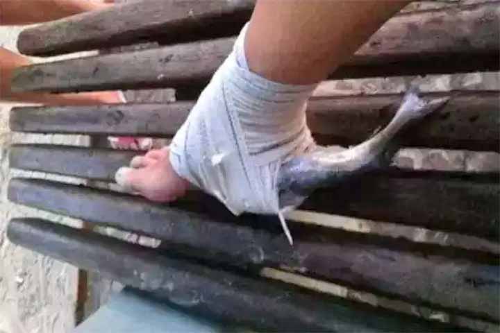 A Prefeitura de Ubatuba reforçou que unidades de saúde devem ser procuradas imediatamente para avaliação e tratamento adequados, a fim de evitar complicações.
