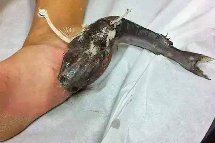 Diante disso, o alerta é para que banhistas evitem tocar nos animais, mesmo quando aparentam estar mortos.
