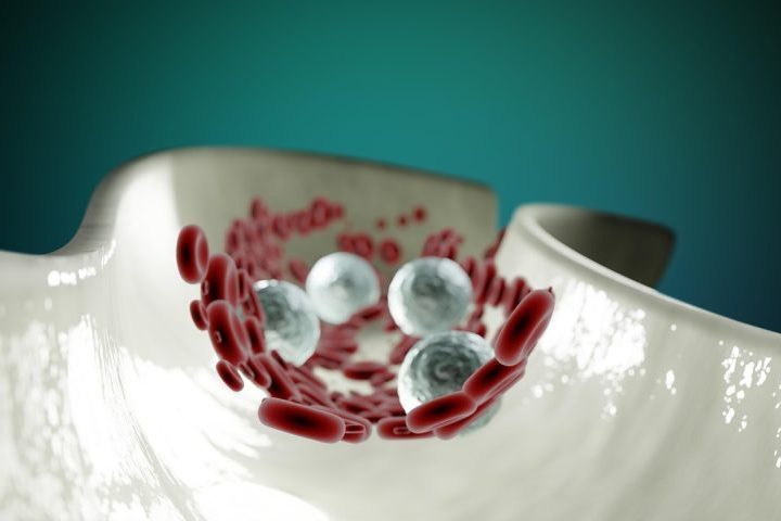 A hipermagnesemia é o termo médico usado para descrever a elevação desregulada da concentração de magnésio no sangue.