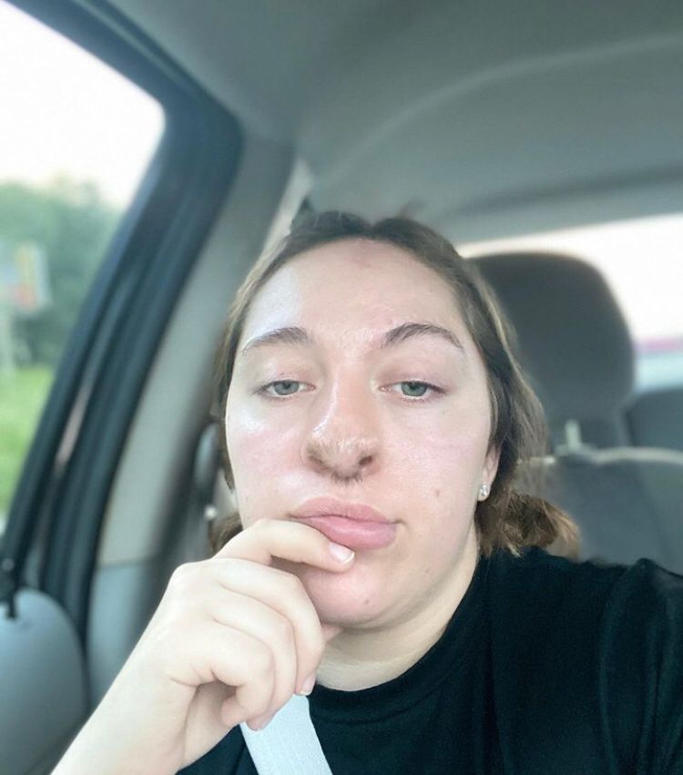 Apesar de todo o trauma, a jovem disse que não culpa o cachorro. “Ele acreditou que estava só protegendo o dono. Ele acreditou que estava fazendo a coisa certa, ainda que me amasse”, declarou a enfermeira.