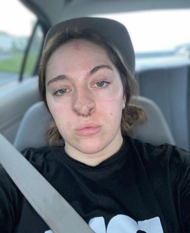 Ela relatou que tudo começou quando ela precisou visitar a casa do pai. Por conta de um desentendimento, eles começaram a discutir, o que teria deixado o animal agitado e agressivo.