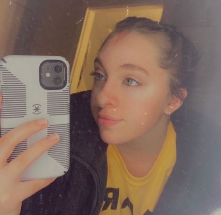 Eu sei do que os cães são capazes agora. Nunca pensei sobre isso antes ou sobre os danos que os cães podem causar, disse ela ao New York Post.