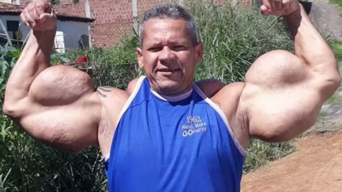 O Popeye Brasileiro se dizia o Rei da Simetria Fisiculturista em suas redes sociais