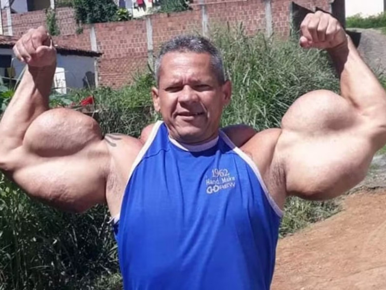 O Popeye Brasileiro se dizia o Rei da Simetria Fisiculturista em suas redes sociais