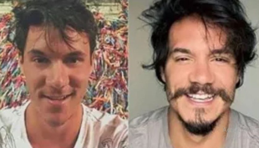 Eliezer – O ex-participante do BBB 22 gastou R$ 14 mil para harmonizar seu rosto e ainda afirmou: Fiquei bonito.