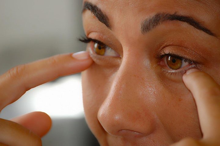 O objetivo não é transformar totalmente a fisionomia, mas suavizar linhas de expressão, corrigir pequenas assimetrias e melhorar o contorno facial.