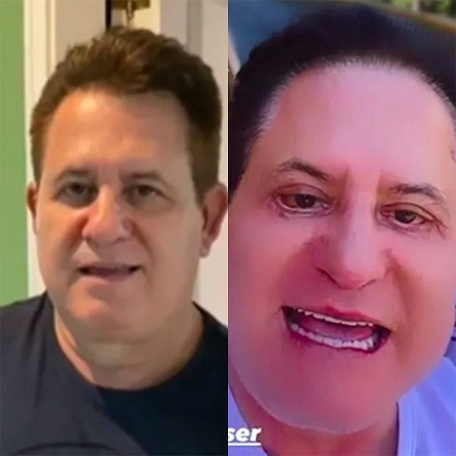 Marrone – O sertanejo apareceu com o rosto completamente modificado em março de 2023 e chegou a virar meme nas redes sociais. Em 2024, ele disse que nunca mais fará plásticas.