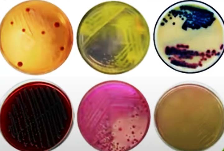 <p>Koch também desenvolveu métodos e técnicas laboratoriais, como a cultura de bactérias em meios sólidos e o uso de corantes para a visualização microscópica de microrganismos, que são práticas até hoje.</p>
