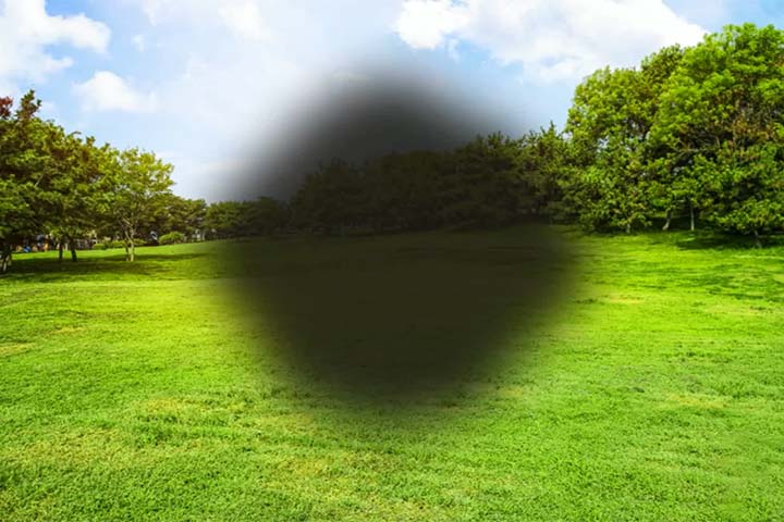 <p>Entre os sintomas mais comuns estão visão embaçada, distorção das linhas retas e dificuldade crescente para reconhecer rostos ou realizar tarefas que exigem foco.</p>
