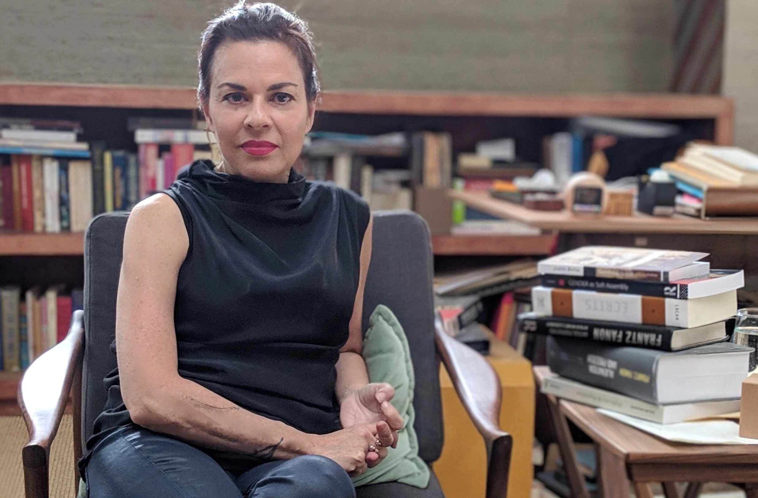 <p>A psicóloga Orna Guralnik explica que crescer com um pai ou mãe instável é devastador: a criança vive em insegurança e vulnerabilidade. Turner enfrentou esse cenário desde cedo, tanto que sua arte pode ser vista como resposta a essa realidade.</p>
