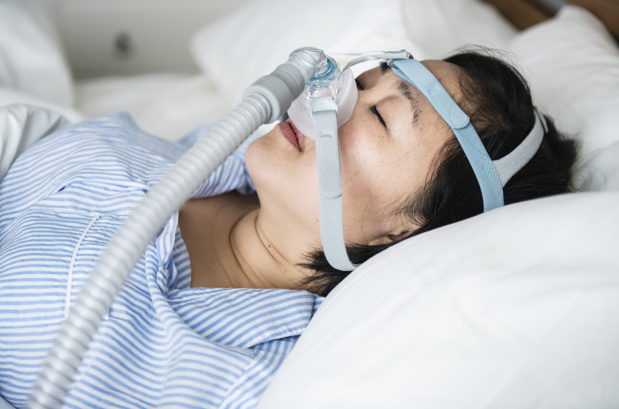 <p>Entre os tratamentos disponíveis, o CPAP se destaca. O aparelho envia fluxo contínuo de ar e mantém as vias aéreas abertas. Hoje, versões mais modernas e silenciosas ajudam a melhorar a adesão.</p>
