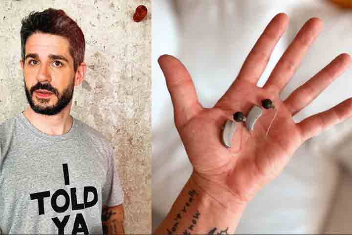 <p>O ator foi diagnosticado com deficiência auditiva aos 18 anos, embora só tenha adotado o uso de aparelho auditivo mais adiante, já depois dos 30 anos.</p><?php if (strpos(site('ds_site_link'), '/apostas') === false): ?>
  </div>

  <div data-type=