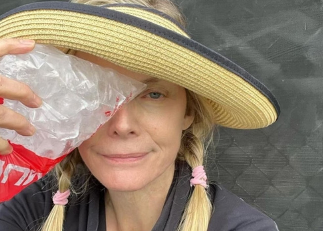 <p>Em seguida, ela postou imagem colocando um saco de gelo no olho e fez o alerta para que as pessoas não brinquem com essa bolinha oca em qualquer lugar. “Aviso: pickleball, fique longe da cozinha”, postou.</p>
