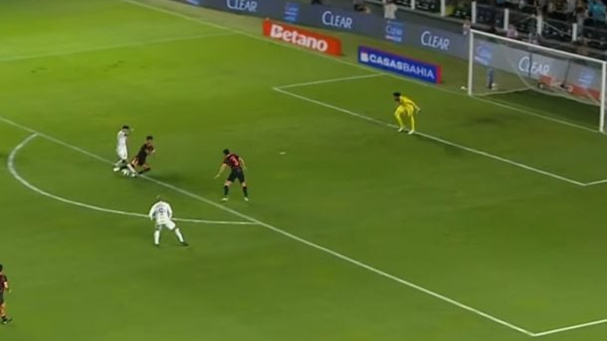 Capitão do Corinthians contesta infração que gerou gol do Santos e publica foto de hematoma após clássico na Vila Belmiro